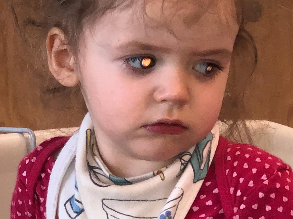 Boo had a brain tumour detected and was the case study for regular eye tests